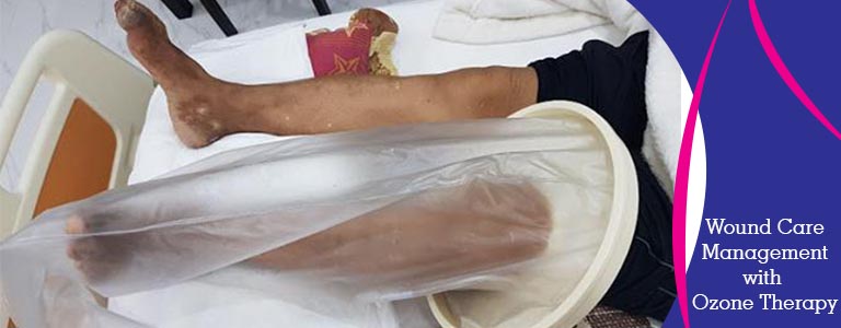 Wound Care Management with Ozone Therapy