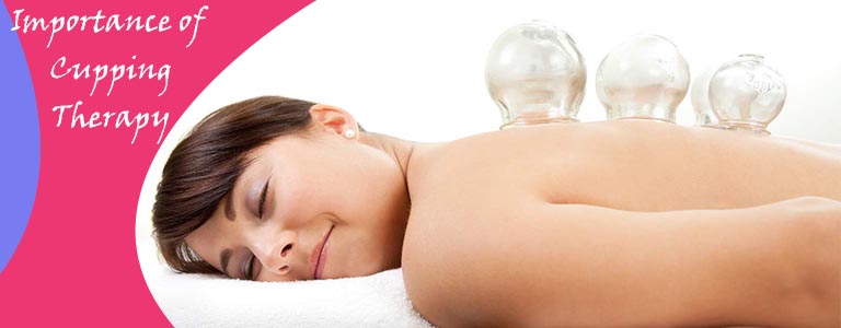 Importance of Cupping Therapy