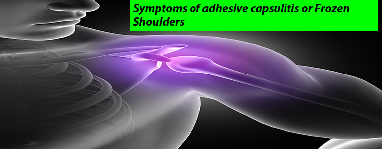 Symptoms of adhesive capsulitis or frozen shoulders