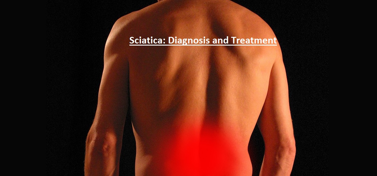 Sciatica: Diagnosis and Treatment